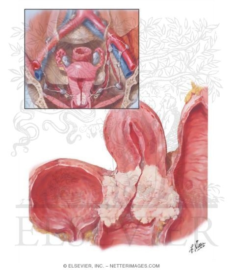 【cervix】什么意思_英语cervix的翻译_音标_读