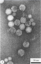 放大的烟草坏死病毒粒子及其卫星病毒粒子